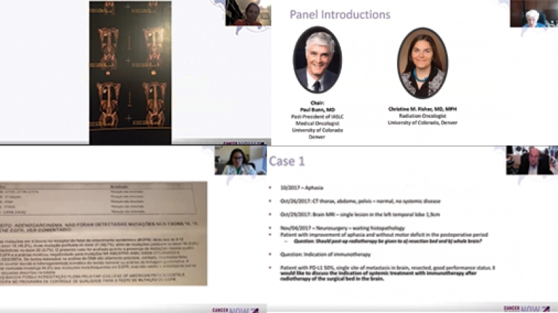 Vídeo do tumor board de câncer de pulmão está disponível